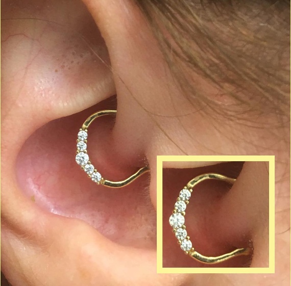 Daith Piercings for Your Health