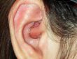 Why You are Getting a Piercing Bump