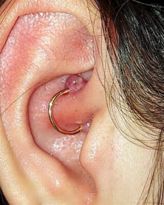 Why You are Getting a Piercing Bump