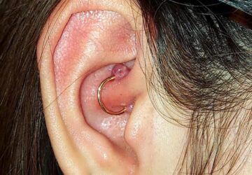 Why You are Getting a Piercing Bump